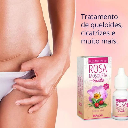Óleo de Rosa Mosqueta